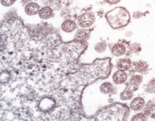 microscopic image of COVID-19 pathogen