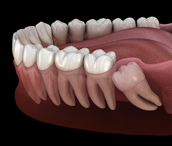 oral-surgery-600x507.jpg